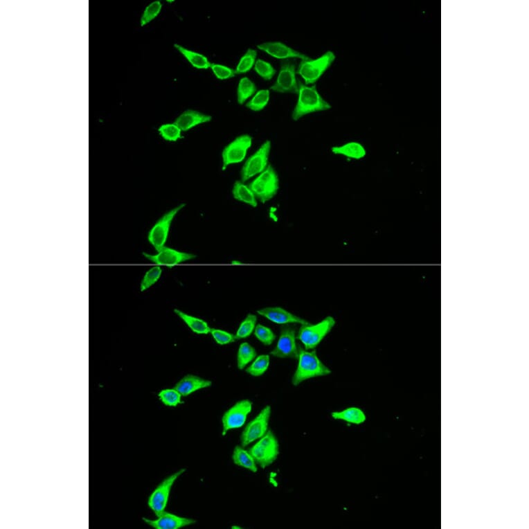 Anti-CD55 Antibody from Bioworld Technology (BS6270) - Antibodies.com