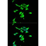 Anti-CD55 Antibody from Bioworld Technology (BS6270) - Antibodies.com