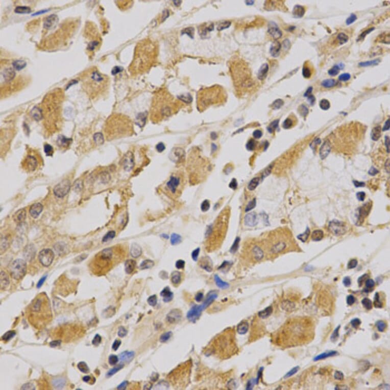 Anti-AMPKα1 Antibody from Bioworld Technology (BS6271) - Antibodies.com