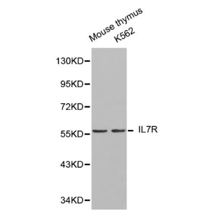 Anti-IL7R Antibody from Bioworld Technology (BS6272) - Antibodies.com
