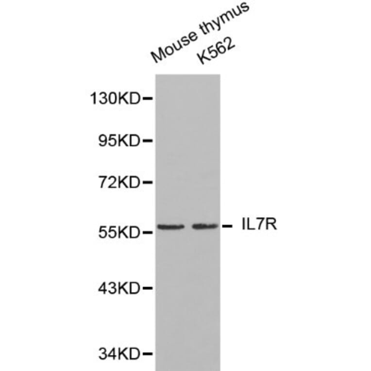 Anti-IL7R Antibody from Bioworld Technology (BS6272) - Antibodies.com