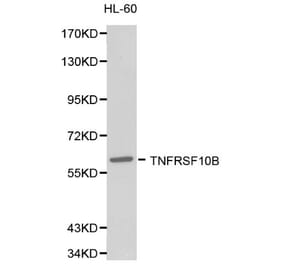Anti-TNFRSF10B Antibody from Bioworld Technology (BS6278) - Antibodies.com