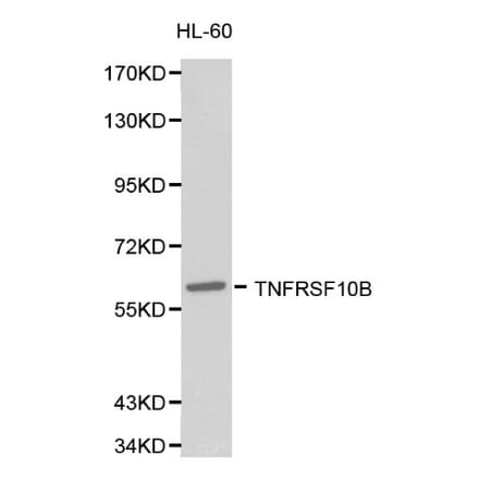 Anti-TNFRSF10B Antibody from Bioworld Technology (BS6278) - Antibodies.com