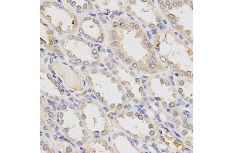 Anti-TNFRSF10B Antibody from Bioworld Technology (BS6278) - Antibodies.com