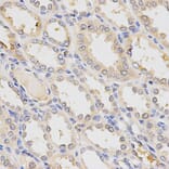 Anti-TNFRSF10B Antibody from Bioworld Technology (BS6278) - Antibodies.com