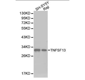 Anti-APRIL Antibody from Bioworld Technology (BS6279) - Antibodies.com