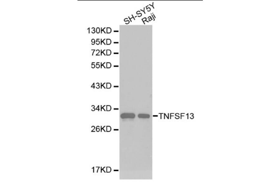 Anti-APRIL Antibody from Bioworld Technology (BS6279) - Antibodies.com