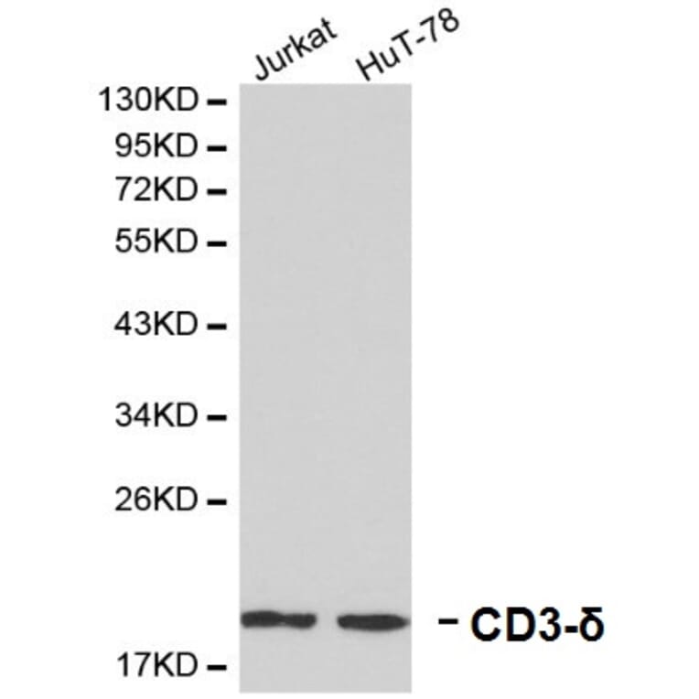 Anti-CD3-δ Antibody from Bioworld Technology (BS6280) - Antibodies.com