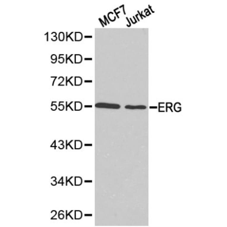 Anti-ERG Antibody from Bioworld Technology (BS6282) - Antibodies.com