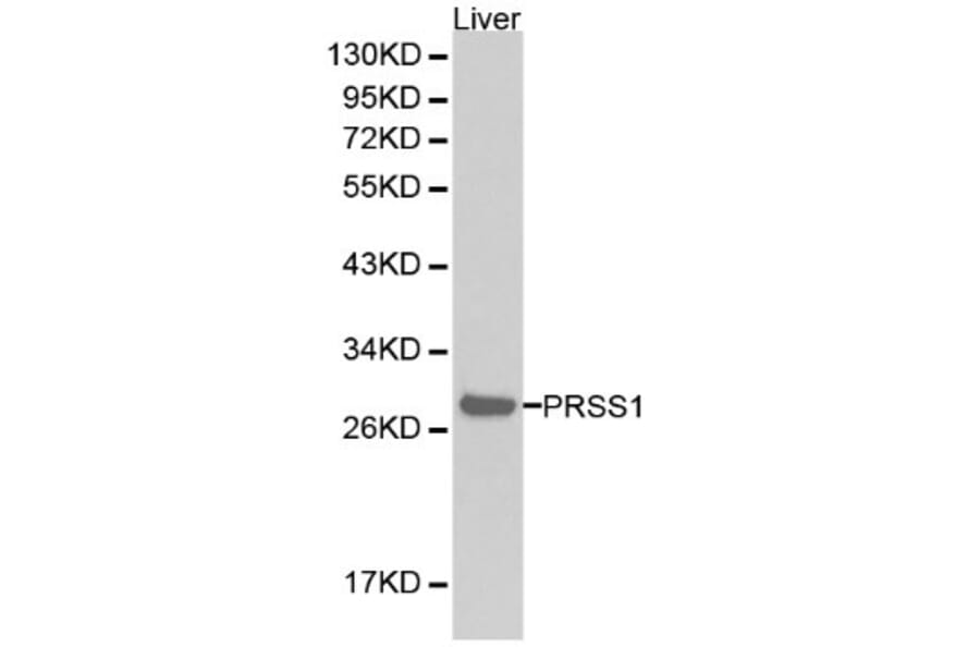 Anti-Trypsin-1 Antibody from Bioworld Technology (BS6284) - Antibodies.com