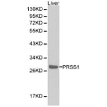 Anti-Trypsin-1 Antibody from Bioworld Technology (BS6284) - Antibodies.com