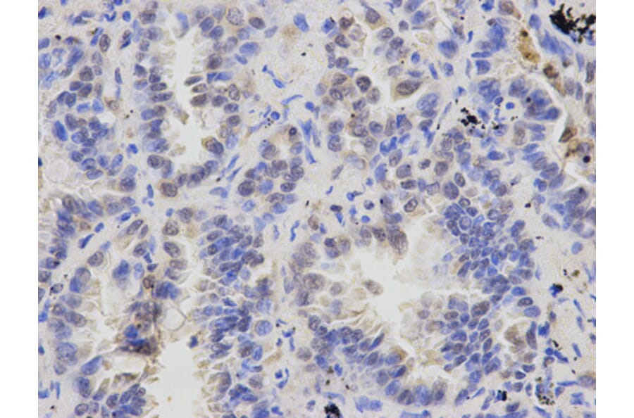 Anti-ATXN3 Antibody from Bioworld Technology (BS6285) - Antibodies.com