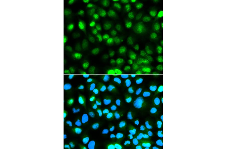 Anti-ATXN3 Antibody from Bioworld Technology (BS6285) - Antibodies.com