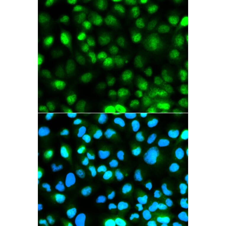 Anti-ATXN3 Antibody from Bioworld Technology (BS6285) - Antibodies.com