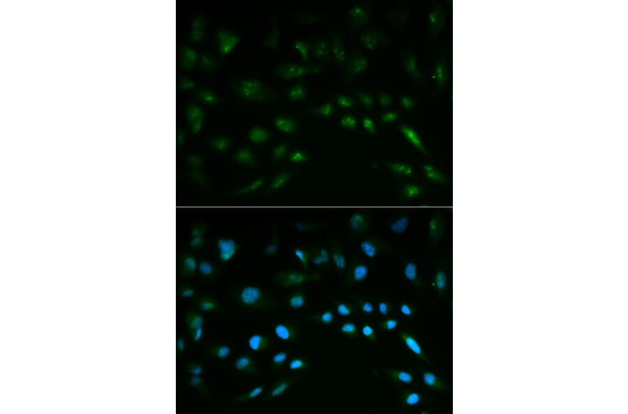 Anti-Nrf2 / NFE2L2 Antibody from Bioworld Technology (BS6286) - Antibodies.com