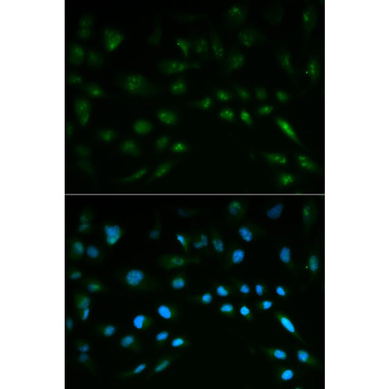 Anti-Nrf2 / NFE2L2 Antibody from Bioworld Technology (BS6286) - Antibodies.com