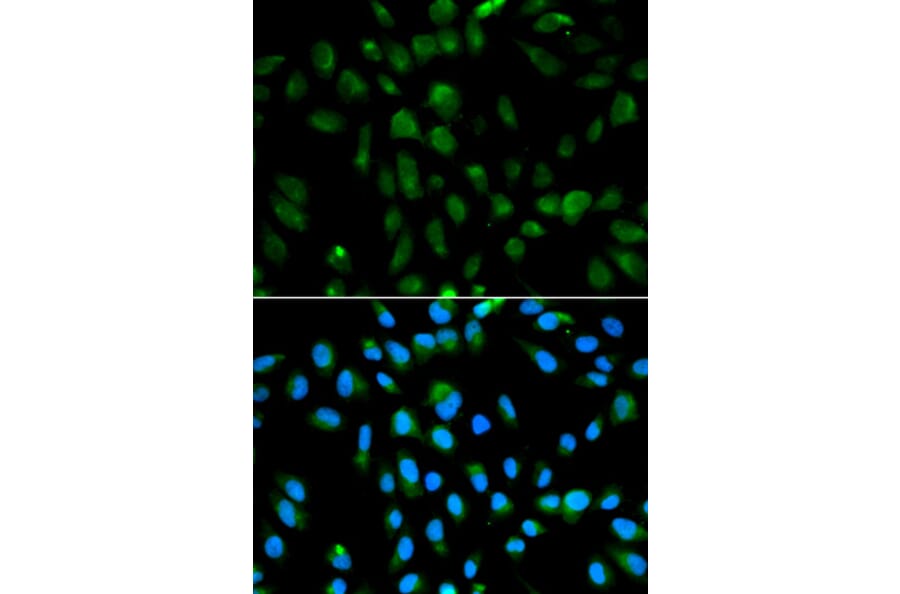 Anti-PSMA3 Antibody from Bioworld Technology (BS6287) - Antibodies.com