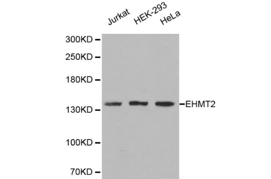 Anti-EHMT2 Antibody from Bioworld Technology (BS6289) - Antibodies.com