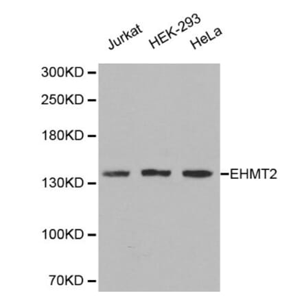 Anti-EHMT2 Antibody from Bioworld Technology (BS6289) - Antibodies.com