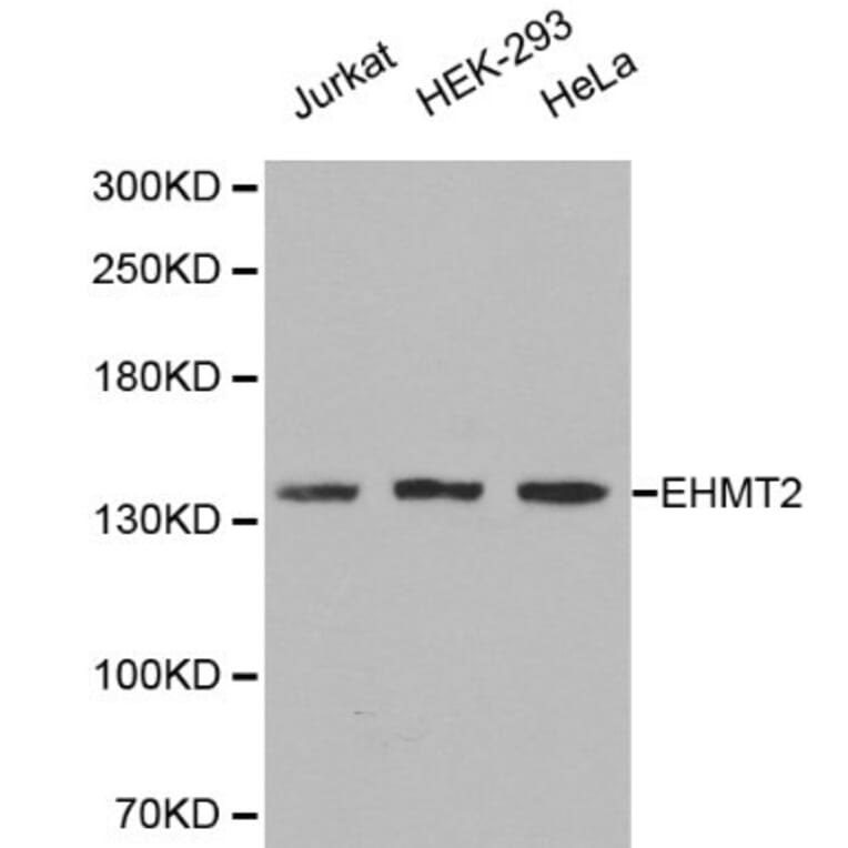 Anti-EHMT2 Antibody from Bioworld Technology (BS6289) - Antibodies.com