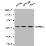 Anti-EHMT2 Antibody from Bioworld Technology (BS6289) - Antibodies.com