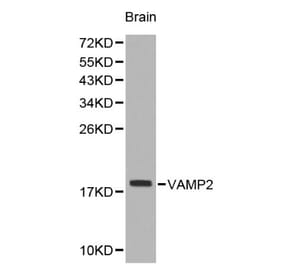 Anti-VAMP2 Antibody from Bioworld Technology (BS6292) - Antibodies.com
