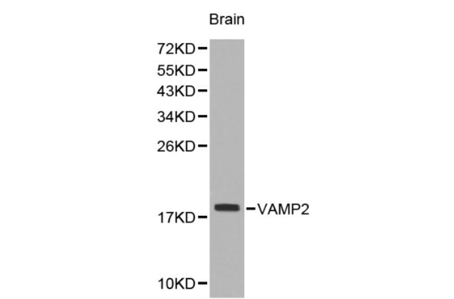 Anti-VAMP2 Antibody from Bioworld Technology (BS6292) - Antibodies.com