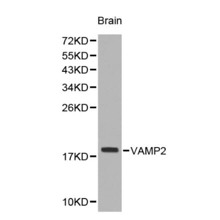 Anti-VAMP2 Antibody from Bioworld Technology (BS6292) - Antibodies.com