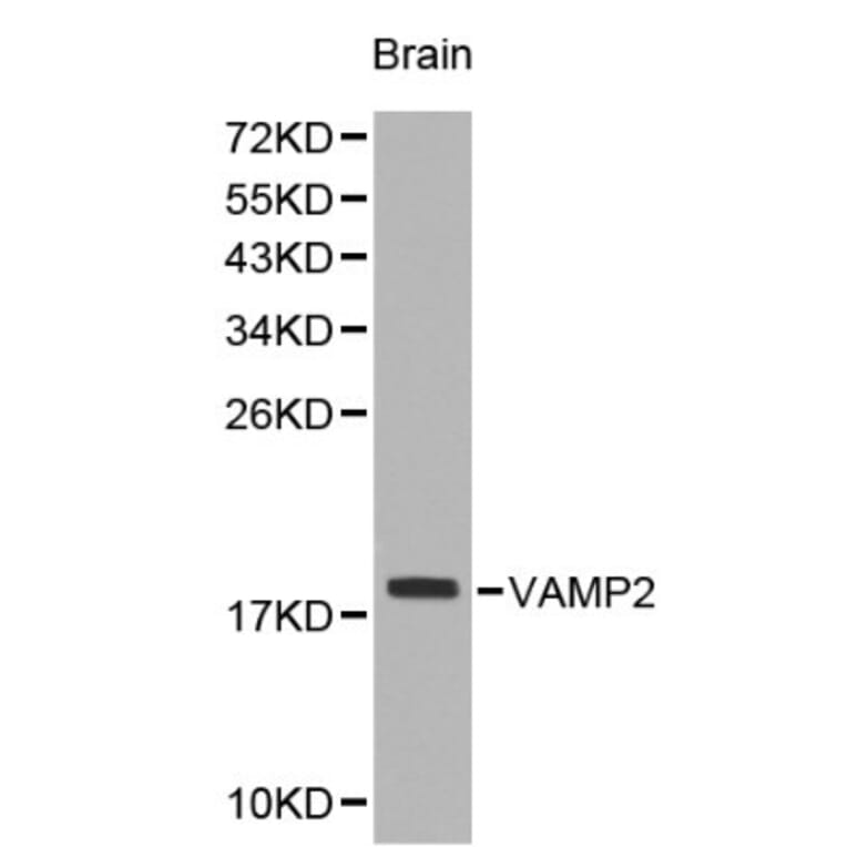 Anti-VAMP2 Antibody from Bioworld Technology (BS6292) - Antibodies.com