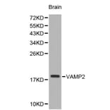 Anti-VAMP2 Antibody from Bioworld Technology (BS6292) - Antibodies.com