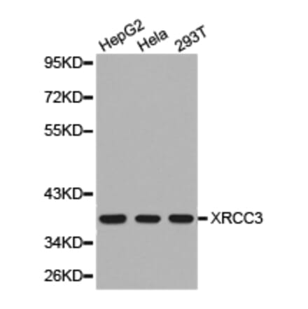 Anti-XRCC3 Antibody from Bioworld Technology (BS6296) - Antibodies.com