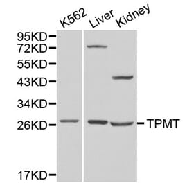 Anti-TPMT Antibody from Bioworld Technology (BS6297) - Antibodies.com