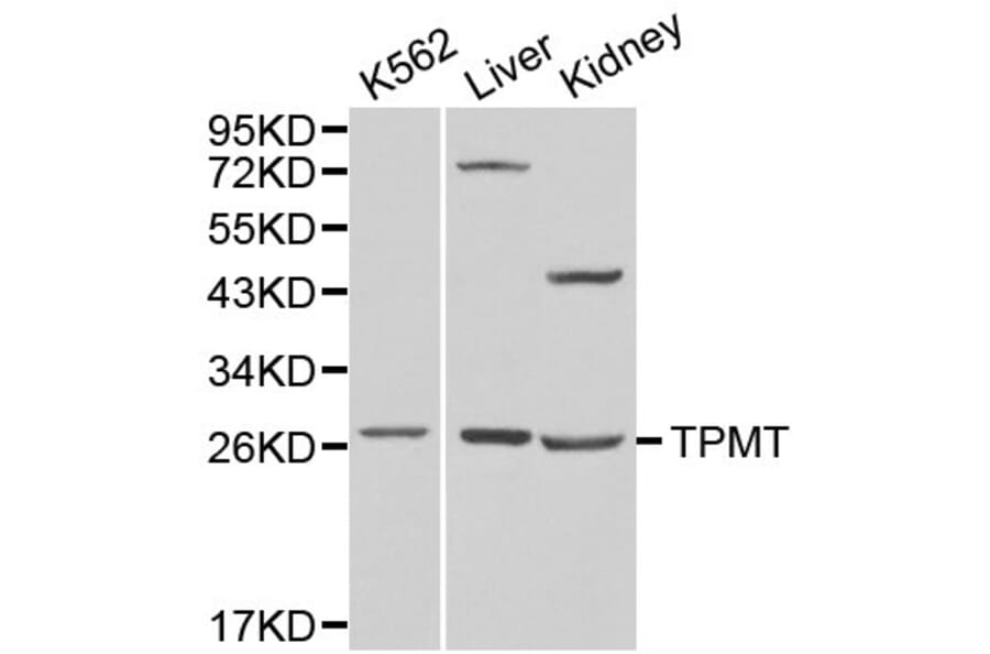 Anti-TPMT Antibody from Bioworld Technology (BS6297) - Antibodies.com