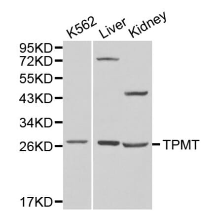 Anti-TPMT Antibody from Bioworld Technology (BS6297) - Antibodies.com