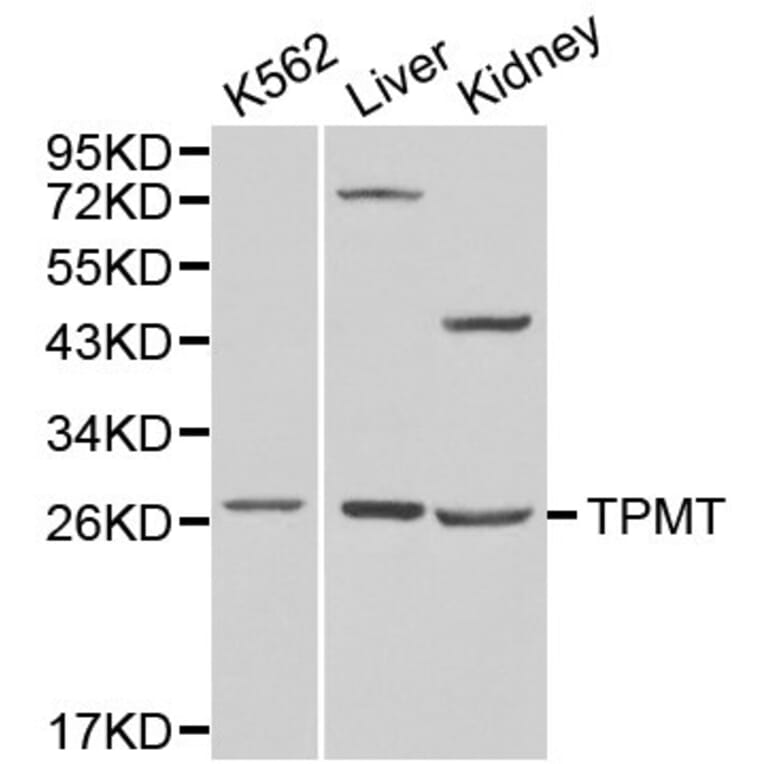 Anti-TPMT Antibody from Bioworld Technology (BS6297) - Antibodies.com