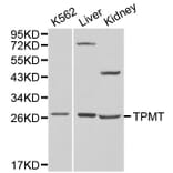 Anti-TPMT Antibody from Bioworld Technology (BS6297) - Antibodies.com