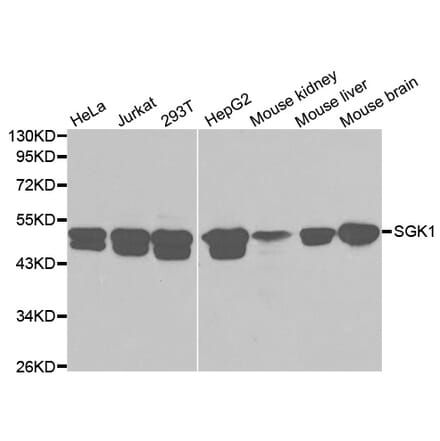 Anti-SGK1 Antibody from Bioworld Technology (BS6304) - Antibodies.com