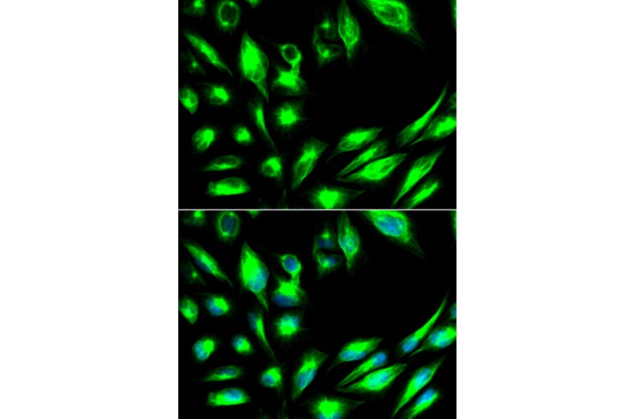 Anti-SGK1 Antibody from Bioworld Technology (BS6304) - Antibodies.com