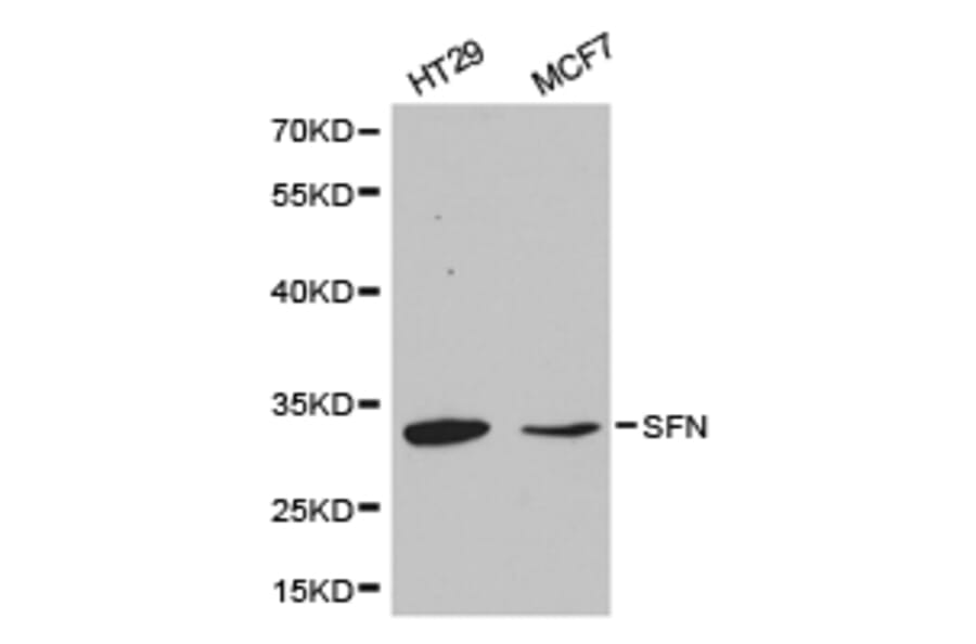 Anti-14-3-3 σ Antibody from Bioworld Technology (BS6305) - Antibodies.com