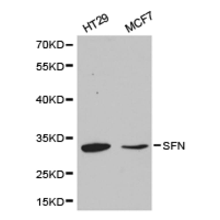 Anti-14-3-3 σ Antibody from Bioworld Technology (BS6305) - Antibodies.com