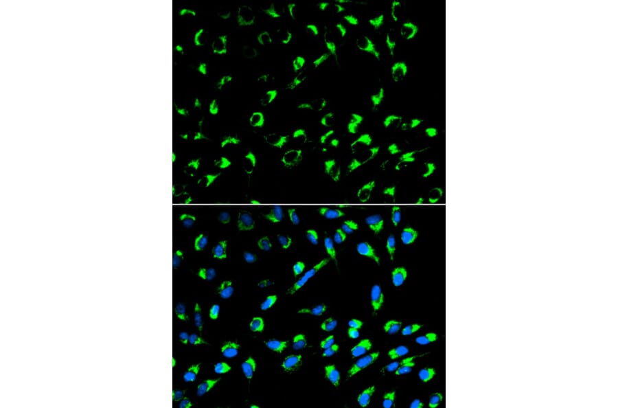 Anti-14-3-3 σ Antibody from Bioworld Technology (BS6305) - Antibodies.com