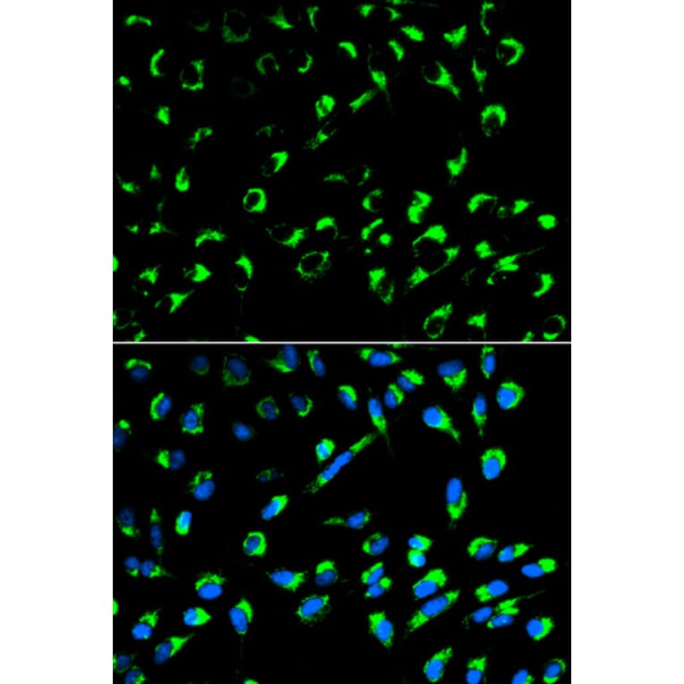 Anti-14-3-3 σ Antibody from Bioworld Technology (BS6305) - Antibodies.com