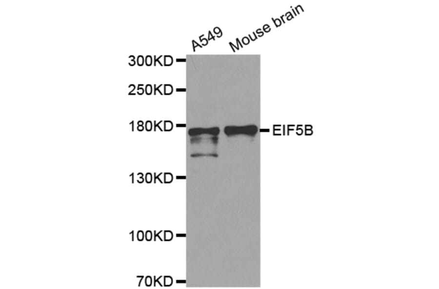 Anti-EIF5B Antibody from Bioworld Technology (BS6306) - Antibodies.com