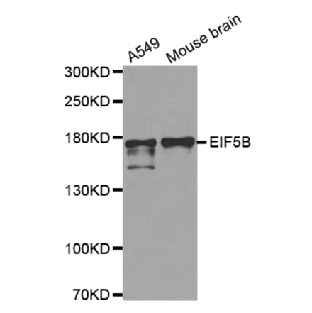 Anti-EIF5B Antibody from Bioworld Technology (BS6306) - Antibodies.com