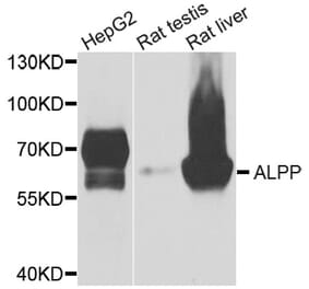 Anti-ALPP Antibody from Bioworld Technology (BS6309) - Antibodies.com