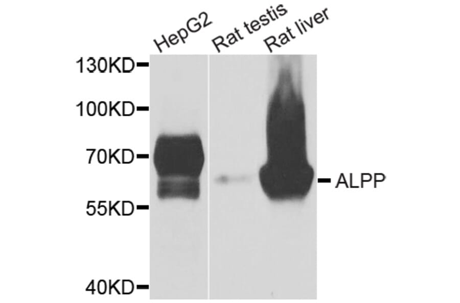 Anti-ALPP Antibody from Bioworld Technology (BS6309) - Antibodies.com