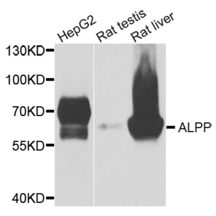 Anti-ALPP Antibody from Bioworld Technology (BS6309) - Antibodies.com