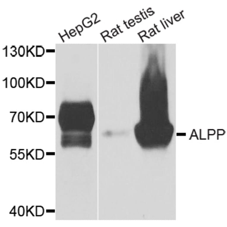 Anti-ALPP Antibody from Bioworld Technology (BS6309) - Antibodies.com