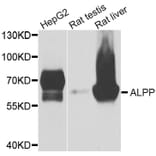 Anti-ALPP Antibody from Bioworld Technology (BS6309) - Antibodies.com