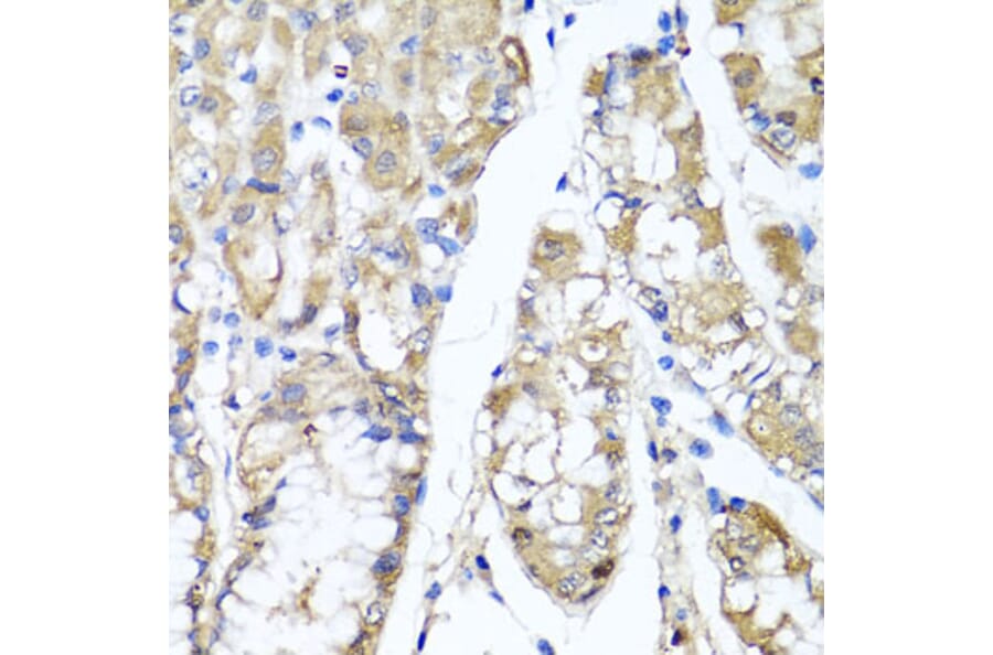 Anti-TNFAIP6 Antibody from Bioworld Technology (BS6310) - Antibodies.com